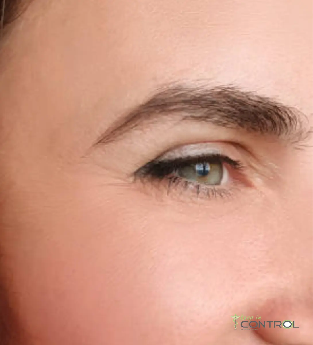botox