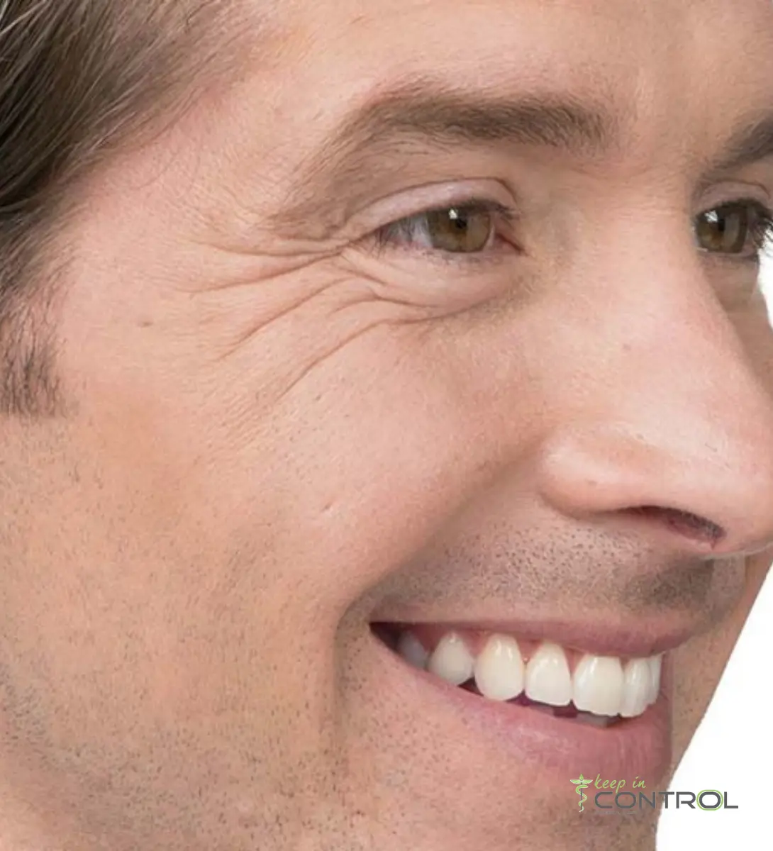 botox